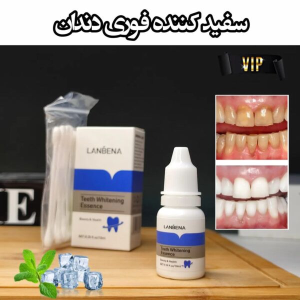 قیمت و خرید قطره سفید کننده دندان لانبنا مخصوص جرم گیری دندان